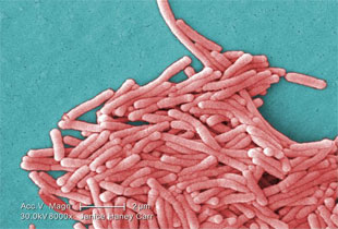 bacteria under colourised scanning electron micrograph